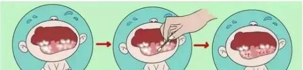 寶寶拒絕喝奶，罪魁禍首可能是它！